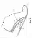 Fig. 06 - Energy return orthotic systems