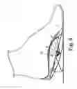 Fig. 07 - Energy return orthotic systems