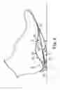 Fig. 09 - Energy return orthotic systems
