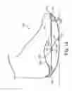 Fig. 16 - Energy return orthotic systems