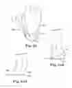 Fig. 35 - Energy return orthotic systems