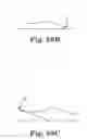 Fig. 40 - Energy return orthotic systems