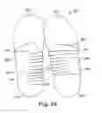 Fig. 41 - Energy return orthotic systems