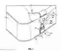 Fig. 02 - Anchoring apparatus for bedclothes