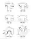 Fig. 04 - User restraint apparatus