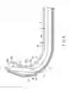 Fig. 07 - INSERTION ASSIST SYSTEM AND INSERTION INSTRUMENT