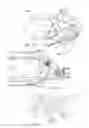 Fig. 09 - Center robotic arm with five-bar spherical linkage for endoscopic camera