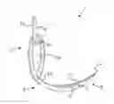 Fig. 01 - Video laryngoscope
