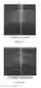 Fig. 06 - Method and system for three-dimensional thickness mapping of corneal micro-layers and corneal diagnoses