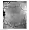 Fig. 01 - Materials and methods for non-invasively measuring temperature distribution in the eye