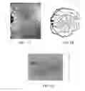 Fig. 02 - Materials and methods for non-invasively measuring temperature distribution in the eye