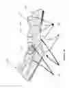 Fig. 10 - DETECTION OF PERIPHERAL ARTERIAL DISEASE