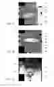 Fig. 03 - Systems and methods for automated voxelation of regions of interest for magnetic resonance spectroscopy