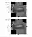 Fig. 04 - Systems and methods for automated voxelation of regions of interest for magnetic resonance spectroscopy