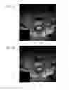 Fig. 06 - Systems and methods for automated voxelation of regions of interest for magnetic resonance spectroscopy