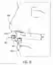 Fig. 07 - Prong-free cannula device for COsampling and Odelivery