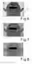 Fig. 05 - APPARATUS AND METHOD FOR DETECTION, QUANTIFICATION AND CLASSIFICATION OF EPIDERMAL LESIONS