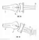 Fig. 02 - Device for sensing displacement during a joint mobilization procedure and method for using such a device to quantify joint mobilization and detect joint laxity