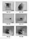Fig. 17 - FULLY IMPLANTABLE SOFT MEDICAL DEVICES FOR INTERFACING WITH BIOLOGICAL TISSUE