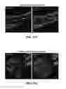 Fig. 29 - FULLY IMPLANTABLE SOFT MEDICAL DEVICES FOR INTERFACING WITH BIOLOGICAL TISSUE