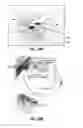 Fig. 32 - FULLY IMPLANTABLE SOFT MEDICAL DEVICES FOR INTERFACING WITH BIOLOGICAL TISSUE