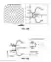 Fig. 40 - FULLY IMPLANTABLE SOFT MEDICAL DEVICES FOR INTERFACING WITH BIOLOGICAL TISSUE
