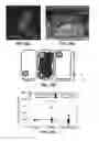 Fig. 43 - FULLY IMPLANTABLE SOFT MEDICAL DEVICES FOR INTERFACING WITH BIOLOGICAL TISSUE