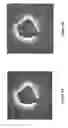 Fig. 07 - Intravascular measurement and data collection systems, apparatus and methods