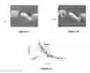 Fig. 08 - Intravascular measurement and data collection systems, apparatus and methods