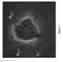 Fig. 09 - Intravascular measurement and data collection systems, apparatus and methods