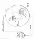 Fig. 05 - Model based variable risk false glucose threshold alarm prevention mechanism