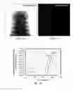 Fig. 07 - Integrated optical blocking filter for compact X-ray imaging detector