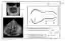 Fig. 01 - ULTRASOUND SYSTEMS AND METHODS FOR AUTOMATIC DETERMINATION OF HEART CHAMBER CHARACTERISTICS