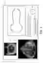 Fig. 04 - ULTRASOUND SYSTEMS AND METHODS FOR AUTOMATIC DETERMINATION OF HEART CHAMBER CHARACTERISTICS