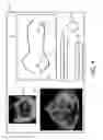 Fig. 05 - ULTRASOUND SYSTEMS AND METHODS FOR AUTOMATIC DETERMINATION OF HEART CHAMBER CHARACTERISTICS