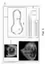 Fig. 06 - ULTRASOUND SYSTEMS AND METHODS FOR AUTOMATIC DETERMINATION OF HEART CHAMBER CHARACTERISTICS