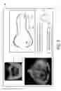 Fig. 07 - ULTRASOUND SYSTEMS AND METHODS FOR AUTOMATIC DETERMINATION OF HEART CHAMBER CHARACTERISTICS