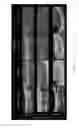 Fig. 10 - Photoacoustic probe