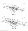 Fig. 02 - Tissue removal system