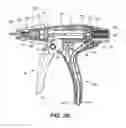 Fig. 14 - Tissue removal system