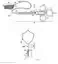 Fig. 02 - Retrieval device