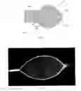 Fig. 06 - Retrieval device