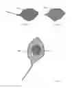 Fig. 10 - Retrieval device