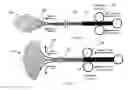 Fig. 13 - Retrieval device
