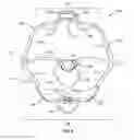 Fig. 07 - Cheek retractor device and method