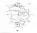 Fig. 08 - Cheek retractor device and method