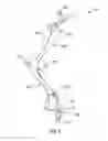 Fig. 09 - Cheek retractor device and method