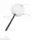Fig. 02 - Alternative use for hydrogel intrasaccular occlusion device with a spring for structural support