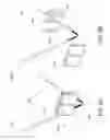 Fig. 07 - Devices, apparatuses, kits, and methods for osteotomy plates, guides, and cutters