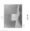 Fig. 09 - Devices, apparatuses, kits, and methods for osteotomy plates, guides, and cutters